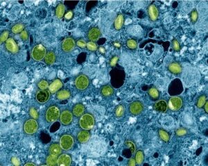 PAMJE MAHNITËSE E QELIZËS (QELIZA-SHKENCA DHE KURANI)