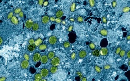 PAMJE MAHNITËSE E QELIZËS (QELIZA-SHKENCA DHE KURANI)